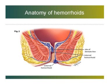 Anatomy of Hemorrhoids